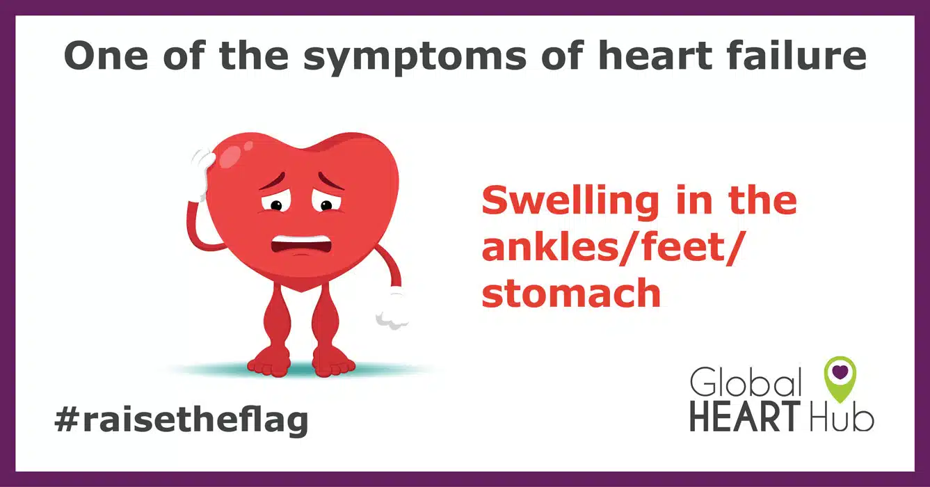 Symptoms of Heart Failure