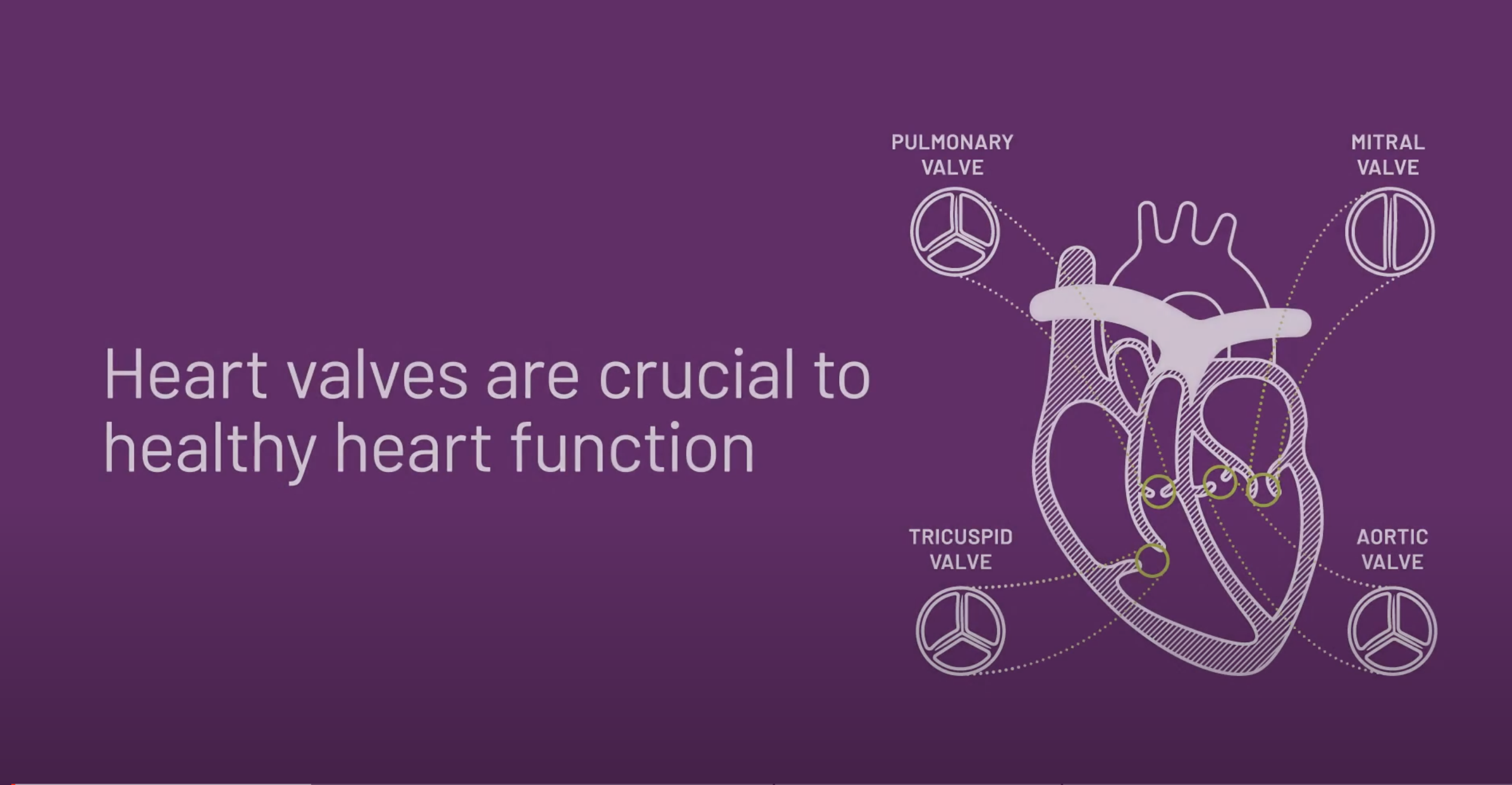 Heart Valve Disease: Working Together to Create a Better Patient Journey